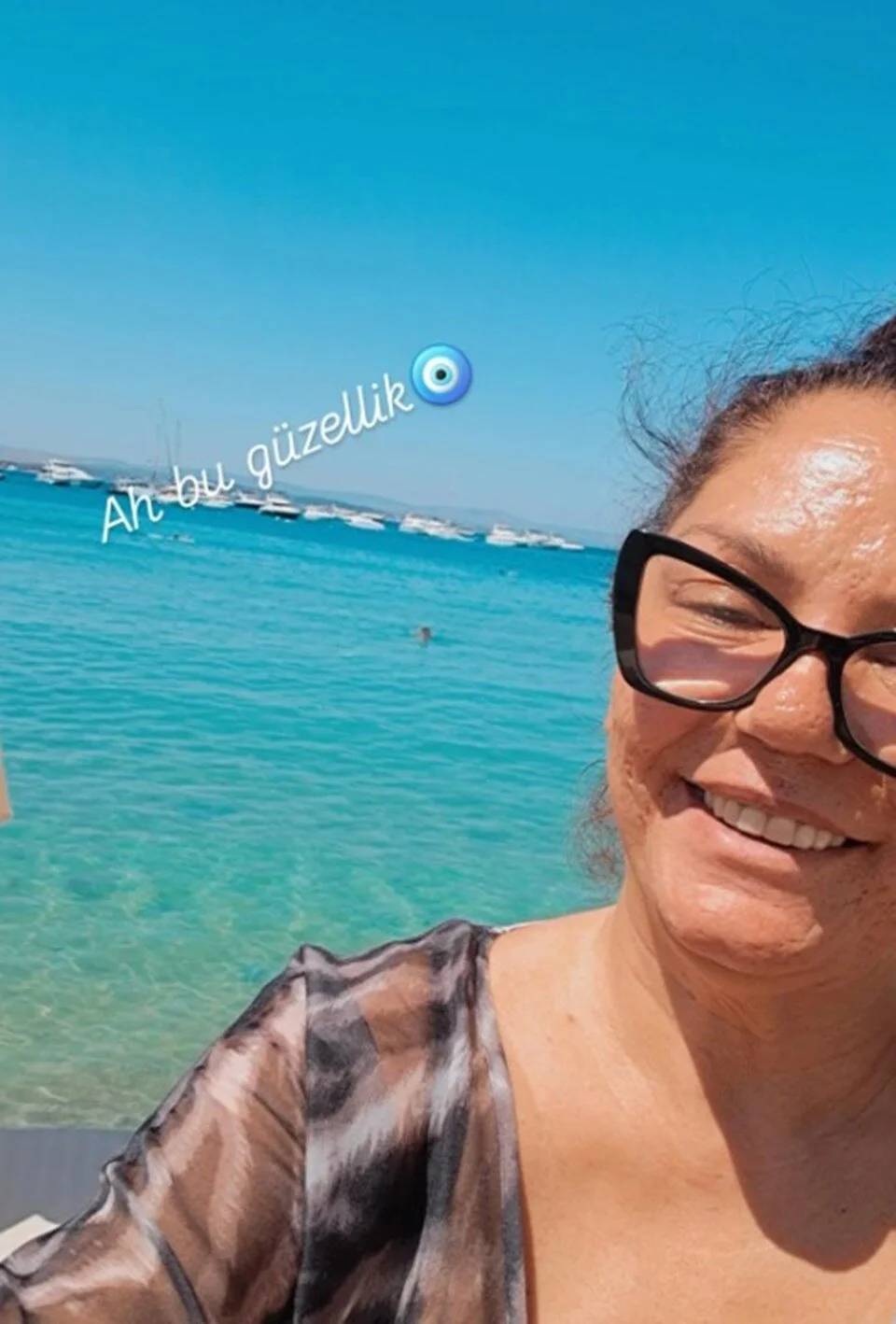 Şarkıcı İzel: Selülitler gerçektir