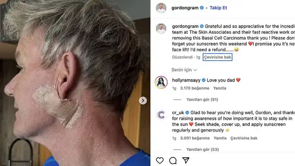 İngiliz Şef Gordon Ramsay Cilt Kanserine Yakalandığını Duyurdu
