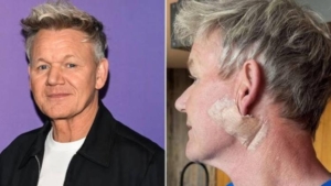 unlu-sef-gordon-ramsay-cilt-kanserine-yakalandigini-acikladi-3nRTpMA9.jpg