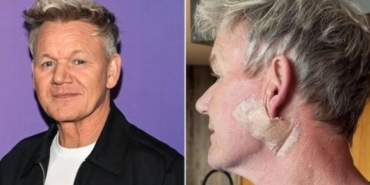 unlu-sef-gordon-ramsay-cilt-kanserine-yakalandigini-acikladi-3nRTpMA9.jpg